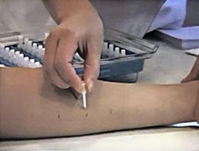 ENSAYOS CLÍNICOS TEWL