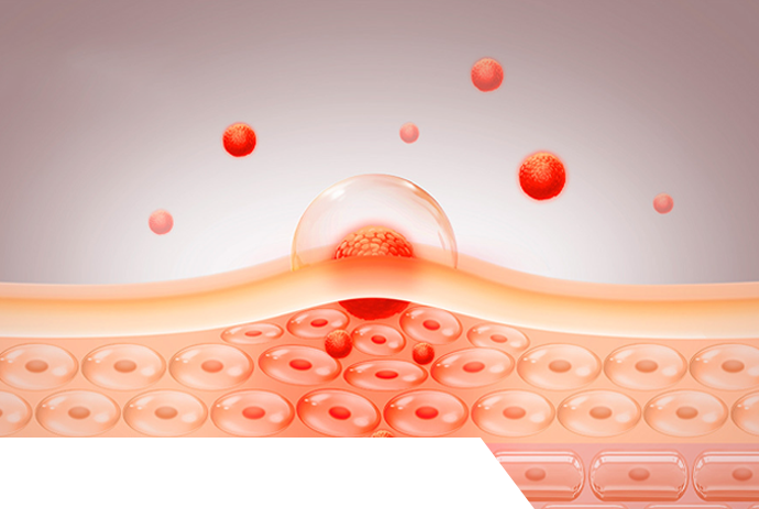 POTENTIAL IRRITATION